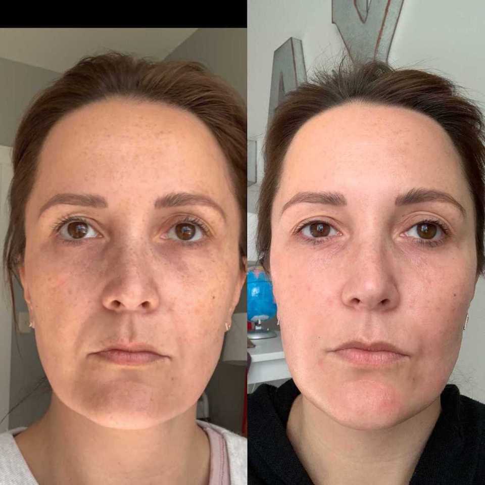 Astaxanthin Facial Essence Skincare Set