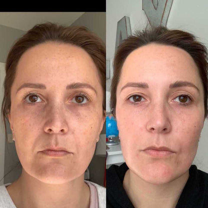 Astaxanthin Facial Essence Skincare Set